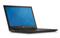 DELL Inspiron 3541 Fekete 3541_167601 small