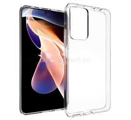 GIGAPACK Redmi Note 11 Pro Plus 5G GIGAPACK Szilikon telefonvédő ultravékony ÁTLÁTSZÓ GP-122938 small