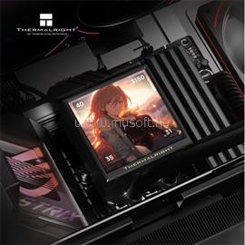 THERMALRIGHT PEERLESS VISION 360 UB ARGB processzor vízhűtő fekete PEERLESS_VISION_360_UB_ARGB_BLACK small