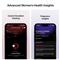 ULTRAHUMAN Ring Air - Smart Ring, Charger, USB Cable / Size-05- Brushed_Rose_Gold UHRA-BR-05 small