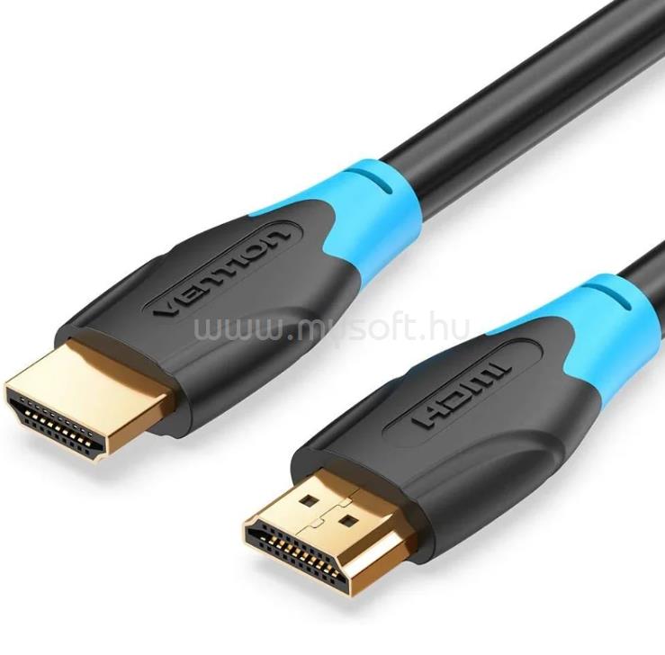 VENTION HDMI 0,75m kábel (fekete)