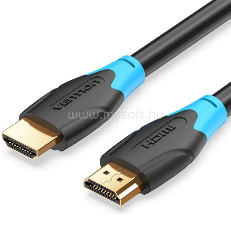 VENTION HDMI 1,5m kábel (fekete)