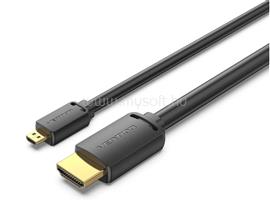 VENTION HDMI-D/M -> HDMI-A/M 4K,HD 1,5m kábel (fekete) AGIBG small