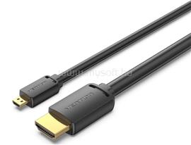 VENTION HDMI-D/M -> HDMI-A/M 4K HD 2m kábel (fekete) AGIBH small