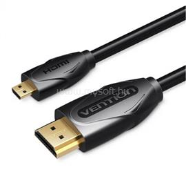 VENTION micro HDMI/M -> HDMI/M, 1m, kábel (fekete) VAA-D03-B100 small