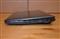 ASUS Eee PC 1215B-BLK199M (fekete) 1215B-BLK199M small