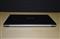 ASUS K551LN-DM056D (szürke) K551LN-DM056D small